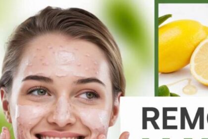 How to Remove Pimples Naturally and Permanently